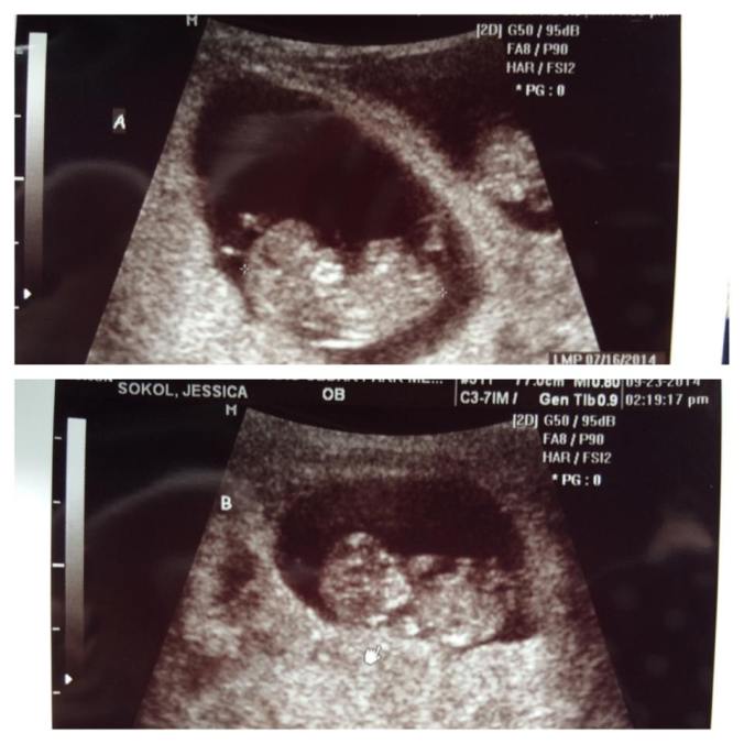 twins 10 weeks